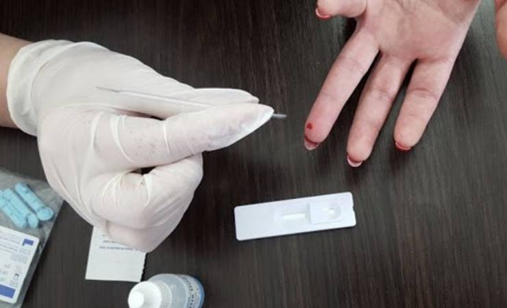 Министр здравоохранения назвал стоимость экспресс-теста на коронавирус