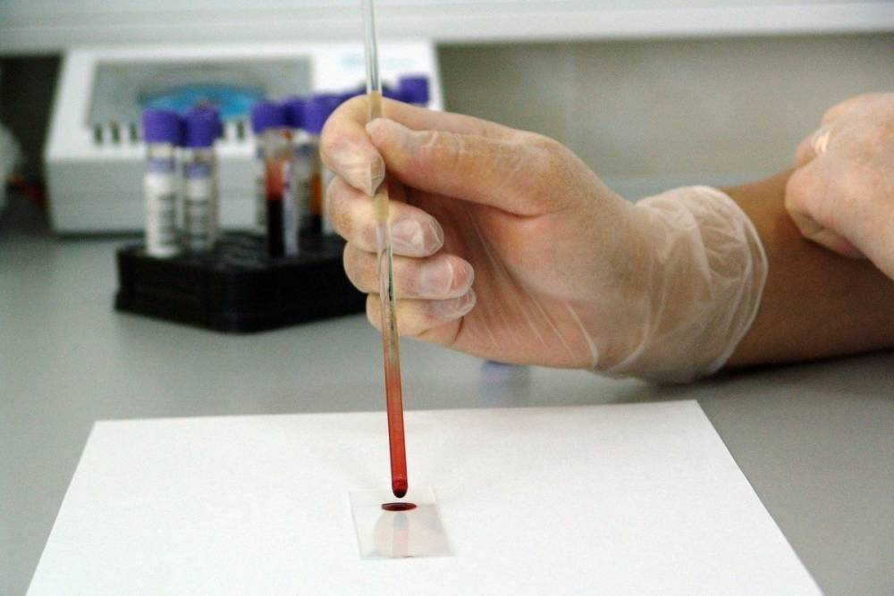 В США одобрили тест на антиген, выявляющий коронавирус за минуты