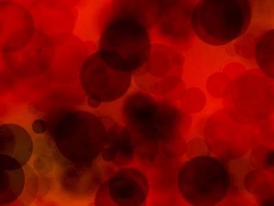 Ученые обнаружили связь между тяжелой формой коронавируса и тромбозом