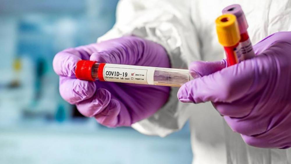 За сутки в Казахстане выявили 440 бессимптомных носителей коронавируса