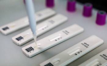 За период пандемии коронавируса в Узбекистане проведено 832 000 лабораторных тестов