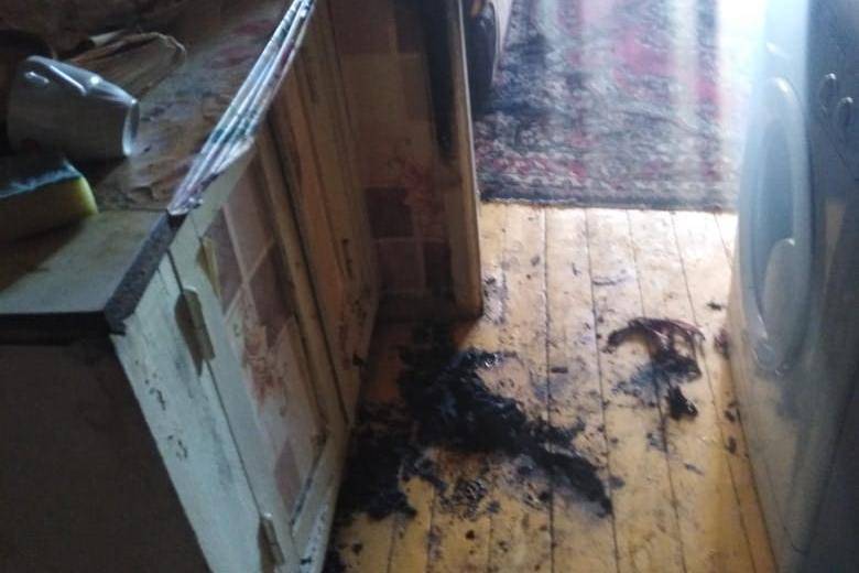 После пожара в Башкирии женщина скончалась в реанимации
