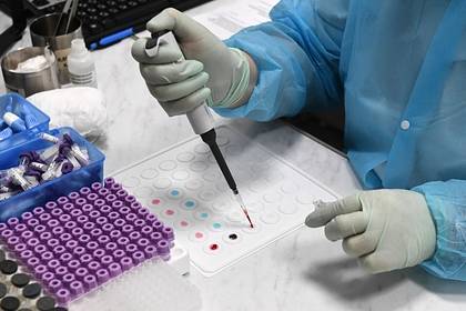 В трех регионах России проведут массовое тестирование на антитела к коронавирусу