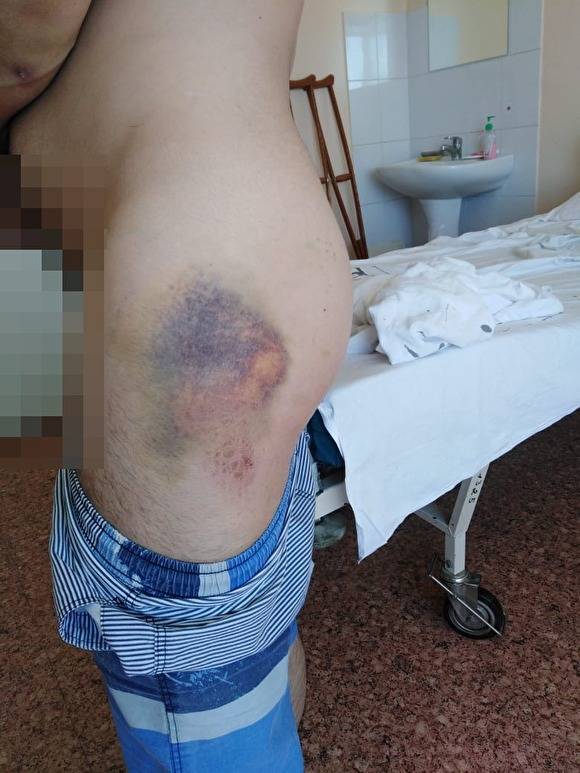 Сотрудник АО «УСТЭК-Челябинск» рассказал, как его на рабочем месте жестоко избил начальник