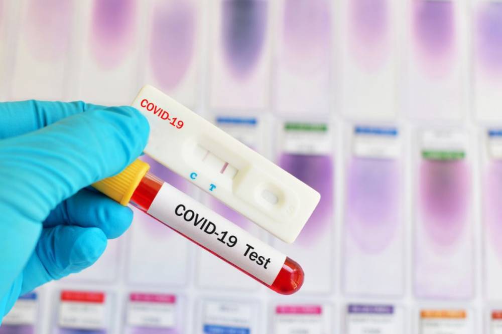В Украине рекорд суточной заболеваемости COVID-19 за все время эпидемии