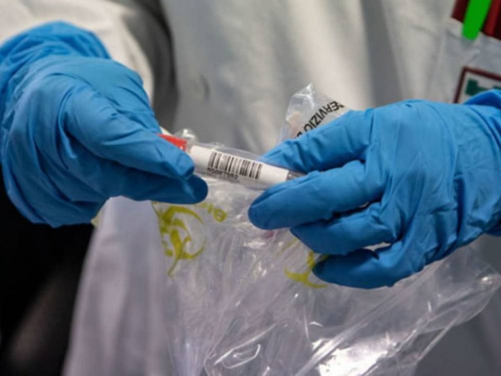 За последние сутки на Буковине коронавирус подтвердили у более чем 40 человек