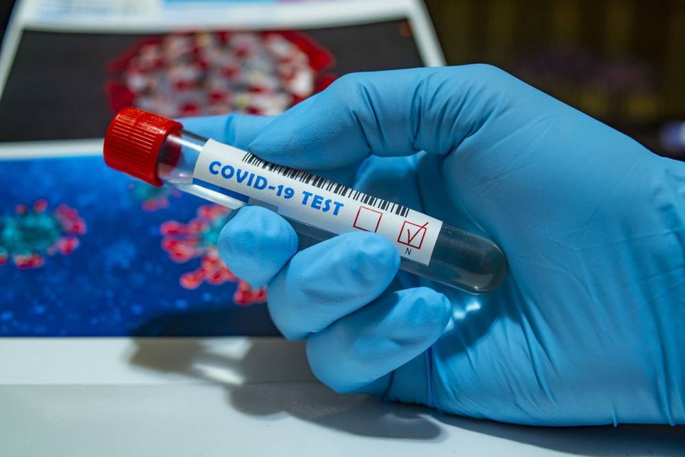 В Беларуси зафиксировали самый низкий за полтора месяца суточный прирост случаев коронавируса