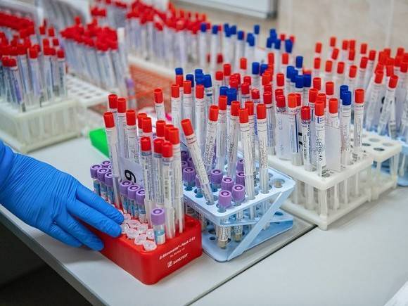 В Москве более 165 тыс. человек сдали тесты на антитела к COVID-19