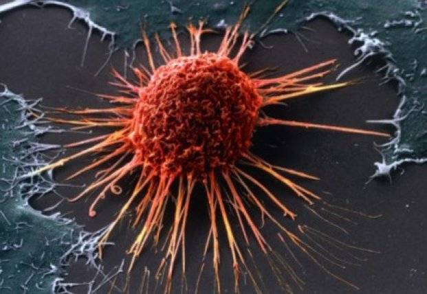 Ученые научились уничтожать раковые клетки голодом