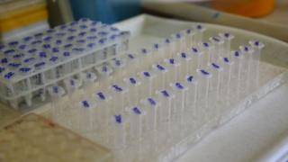 Коронавирус в мире: в США тестируют лекарство, пандемия в Африке набирает скорость