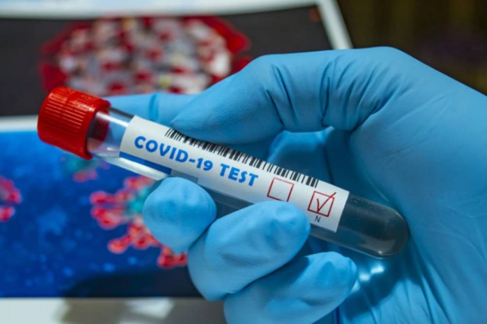 В Украине за сутки вновь зафиксировали почти 700 новых случаев коронавируса