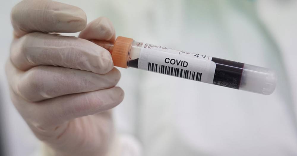 Минобороны испытает вакцину от коронавируса на 50 военных