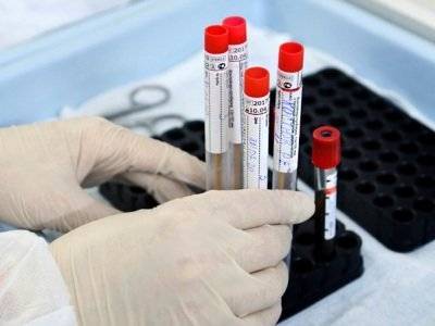 В Арцахе выявлено 8 новых случаев коронавируса