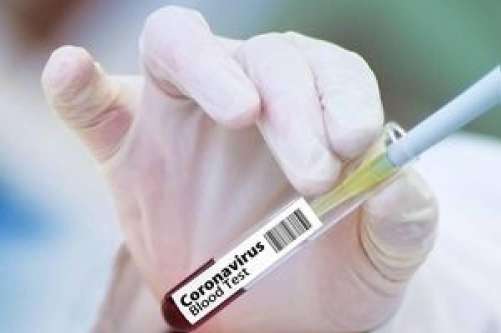 ВОЗ: в мире разрабатываются 133 вакцины от COVID-19