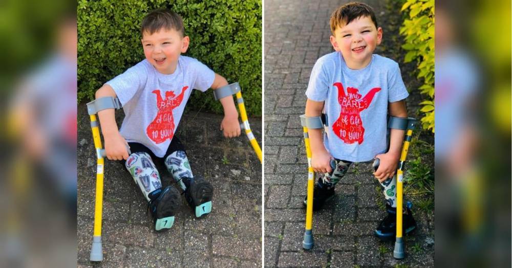 Пройдя на протезах 10 км, 5-летний британец собрал полтора миллиона долларов, чтобы отблагодарить врачей