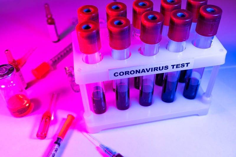 Ученые подтвердили теорию химерного происхождения коронавируса - Cursorinfo: главные новости Израиля