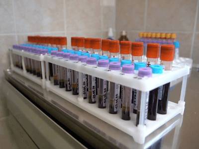 Минобороны раскрыло подробности подготовки к испытаниям «военной» вакцины от коронавируса