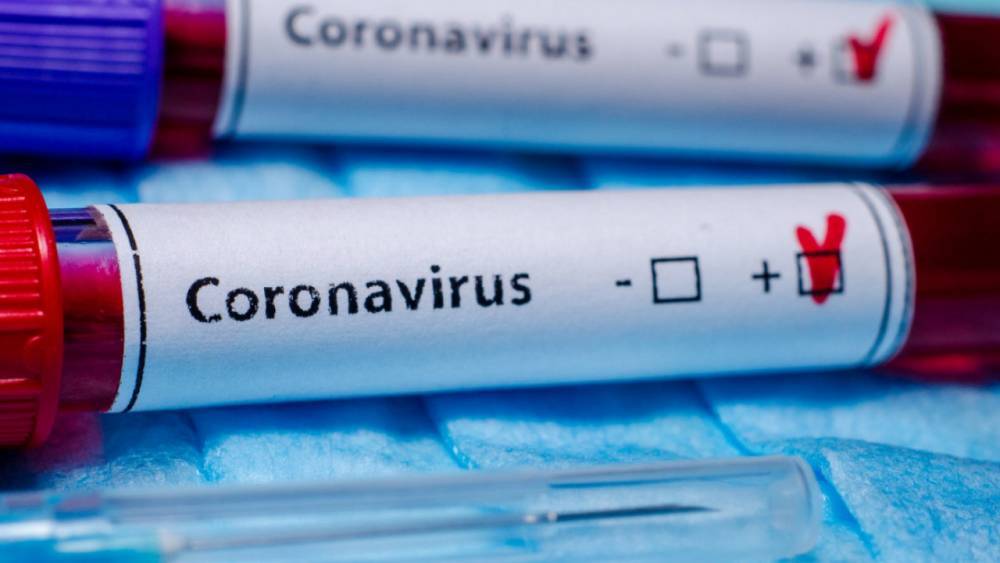 12 067 достигло число зараженных коронавирусом в Казахстане