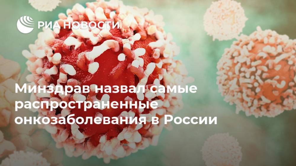 Минздрав назвал самые распространенные онкозаболевания в России