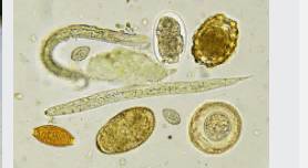 Названы 7 признаков наличия паразитов в организме