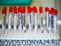 Эксперт усомнился в целесообразности тестирования на антитела к COVID-19