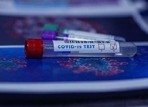 В США начнут использовать новый тест на коронавирус