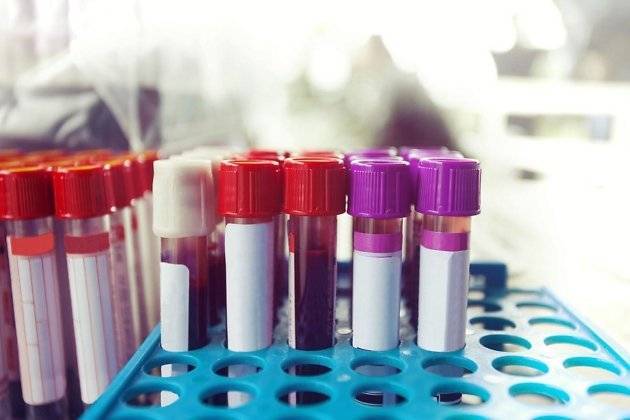 Анализ на наличие антител к COVID-19 проведёт клиническая больница «РЖД-Медицина» в Чите