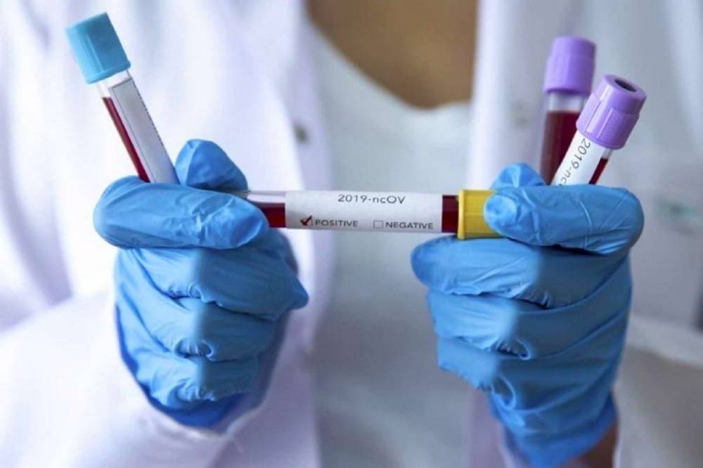 За последние сутки в Украине подтвердили 612 новых случаев коронавируса
