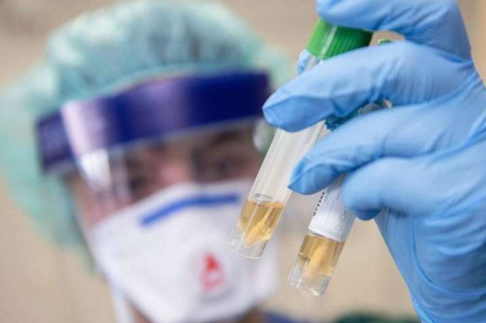 За последние сутки в Украине подтвердили 638 новых случаев коронавируса