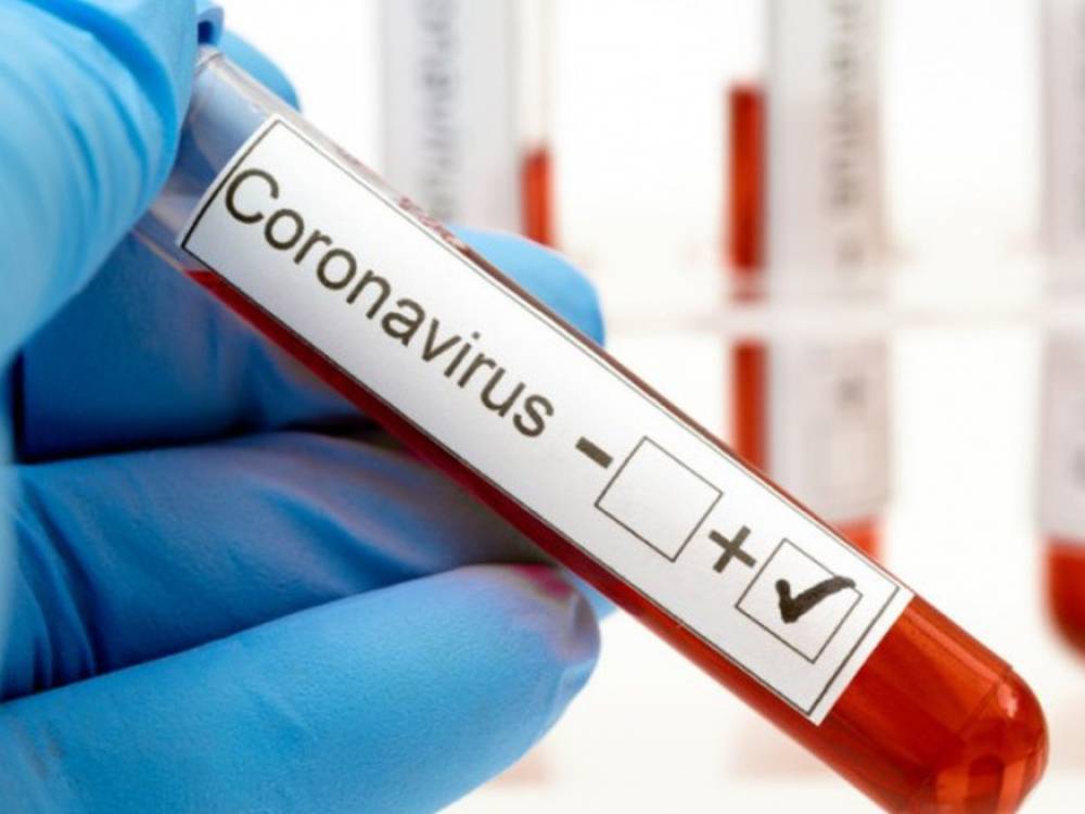Минздрав: наибольшее количество заболеваний коронавирусом зафиксировано в Киеве и 2 областях