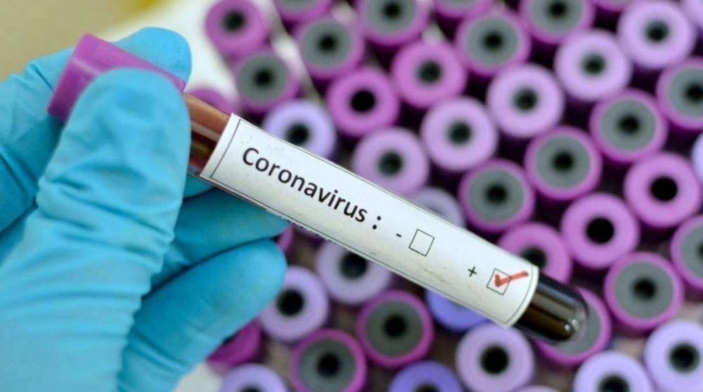 В Украине за сутки обнаружили 731 новый случай коронавируса