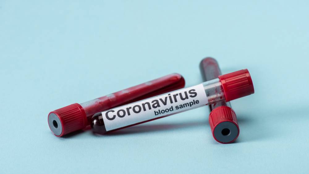 За сутки в Казахстане выявили 1499 заболевших коронавирусом