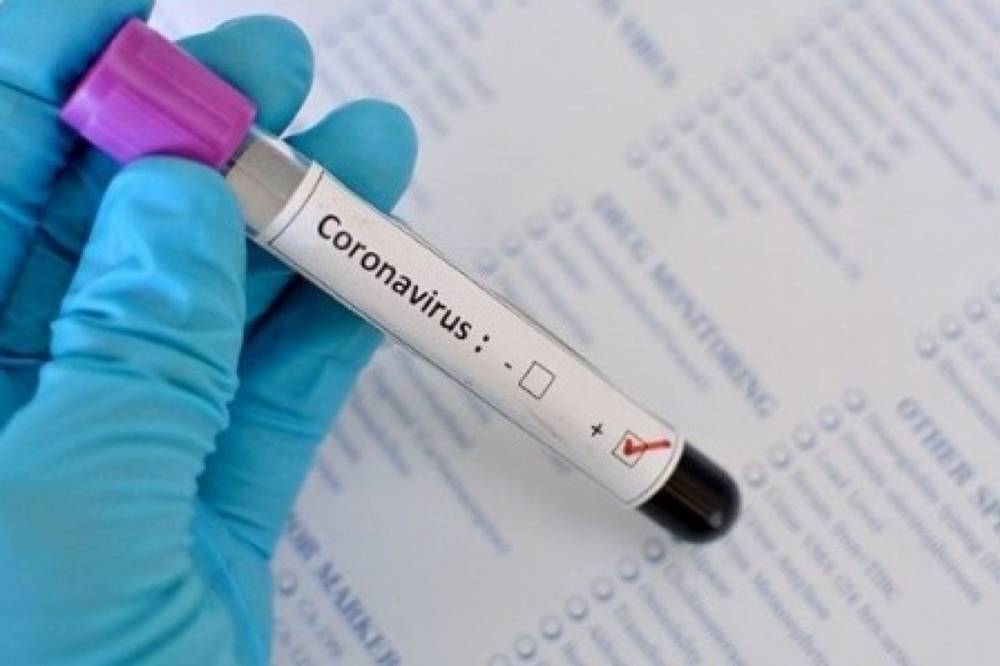 За последние сутки в Украине обнаружили 651 новый случай коронавируса