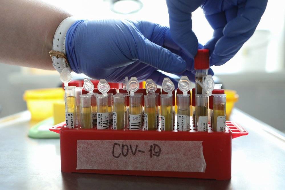 Власти Владимирской области уточнили данные о дважды заразившемся COVID-19 враче