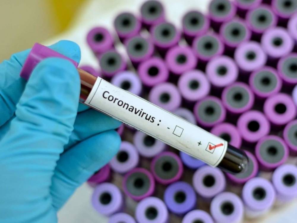 За последние сутки в Украине подтвердили 920 новых случаев коронавируса