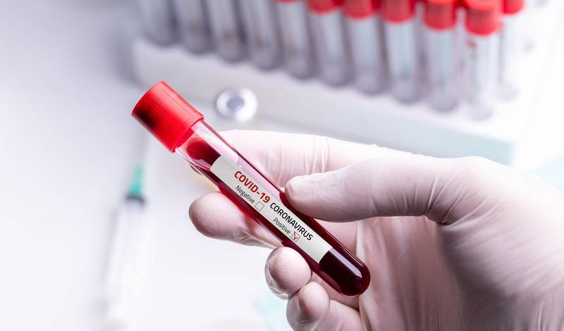 В Испании разработали тест с точностью 98% на антитела к коронавирусу