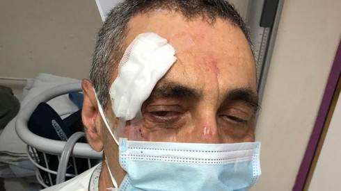 Бросил в лицо тележку с лекарствами: нападение на медбрата в психбольнице "Лев ха-Шарон"