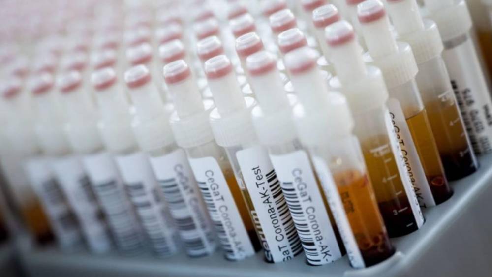 Заболеваемость растет: за сутки в Германии зарегистрировали почти 1500 новых случаев заражения коронавирусом