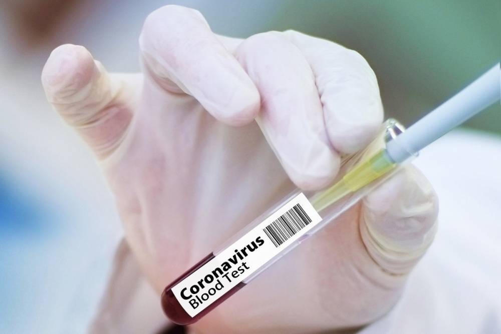 Стали известны побочные эффекты российской вакцины от коронавируса