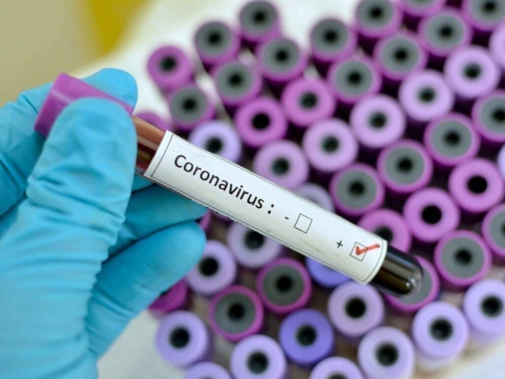 В Украине за сутки зафиксировали новый антирекорд заражения коронавирусом