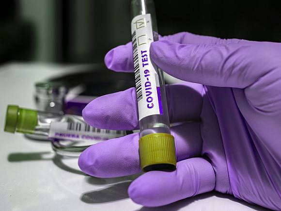 ВОЗ сообщила о рекордном суточном приросте случаев коронавируса