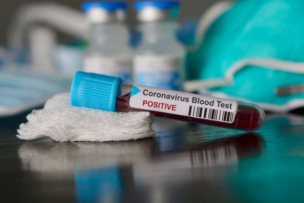 Коронавирус не отступает: В Украине за сутки выявлено 2 462 инфицированных COVID-19