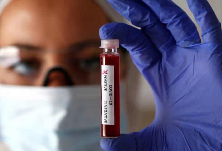 За последние сутки коронавирус нашли у еще 5,5 тысяч россиян