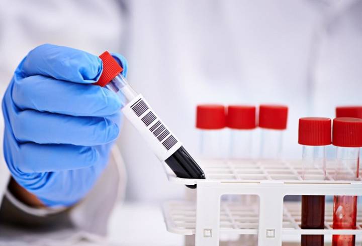 38 новых случаев коронавируса выявили в 12 районах Ленобласти