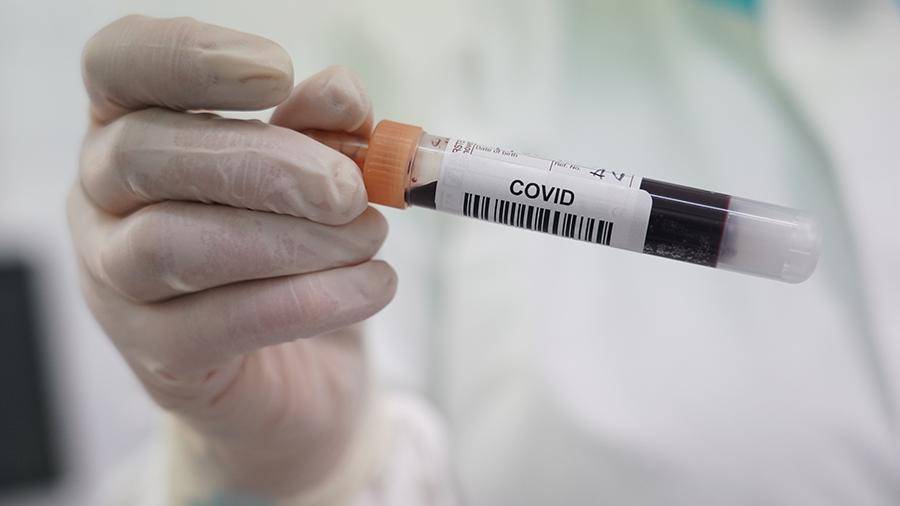 Вирусолог объяснил, почему переболевшие COVID могут выделять вирус 90 дней
