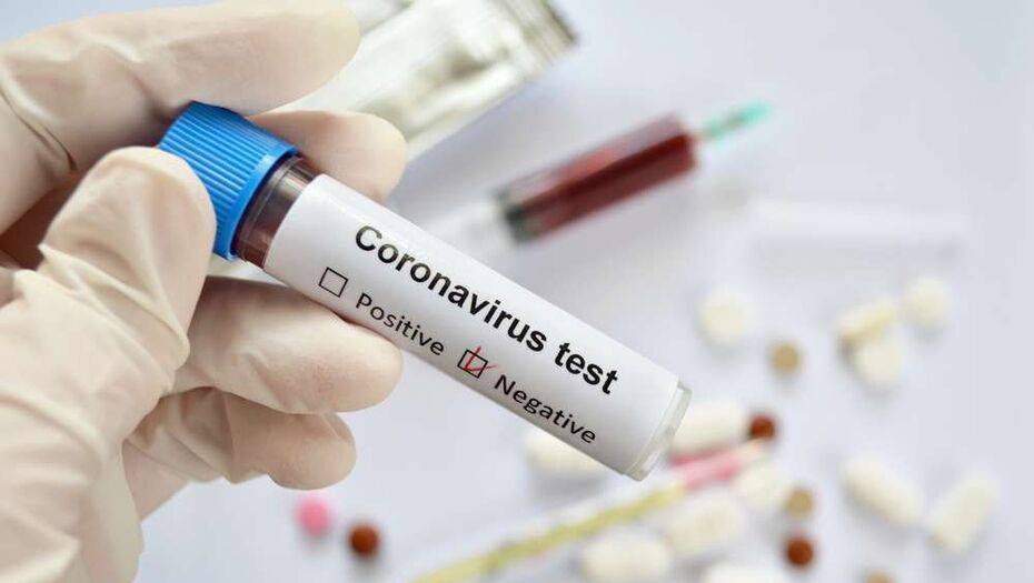 В Казахстане за сутки выявили 263 больных коронавирусной пневмонией