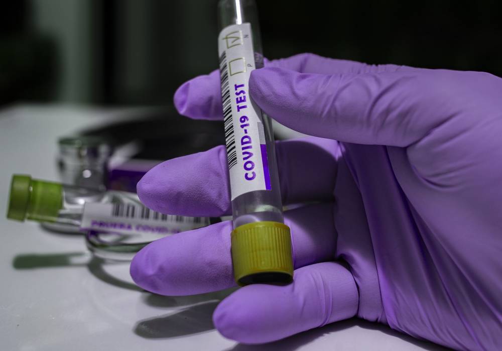 Новый антирекорд: в Украине за сутки 3584 новых случаев коронавируса