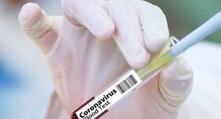 Минздрав Ростовской области отчитался о получении вакцины от COVID-19