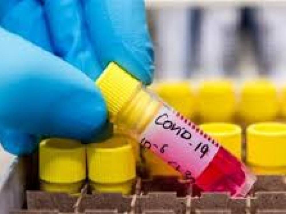США отказались разрабатывать вакцину от коронавируса под эгидой «коррумированной ВОЗ»