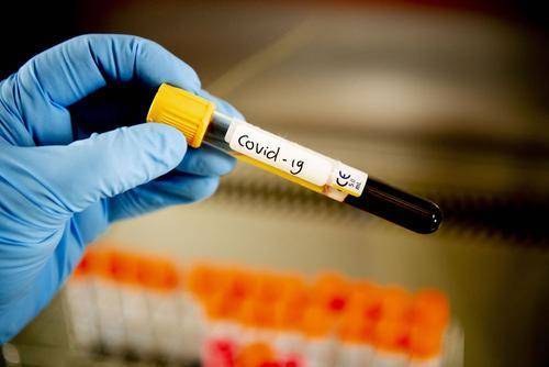 В России за сутки выявили 7 867 случаев заражения коронавирусом